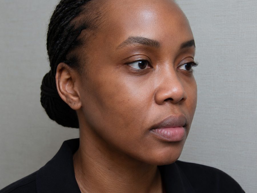 Pigmentation after treatment