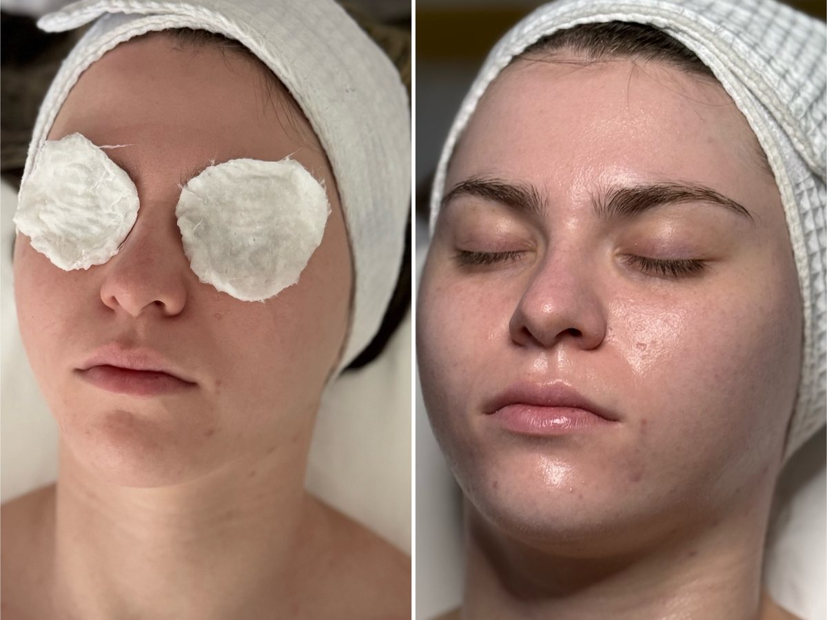 Before and after photos of a Le Miracle client with dull skin, more hydrated and glowing after treatment