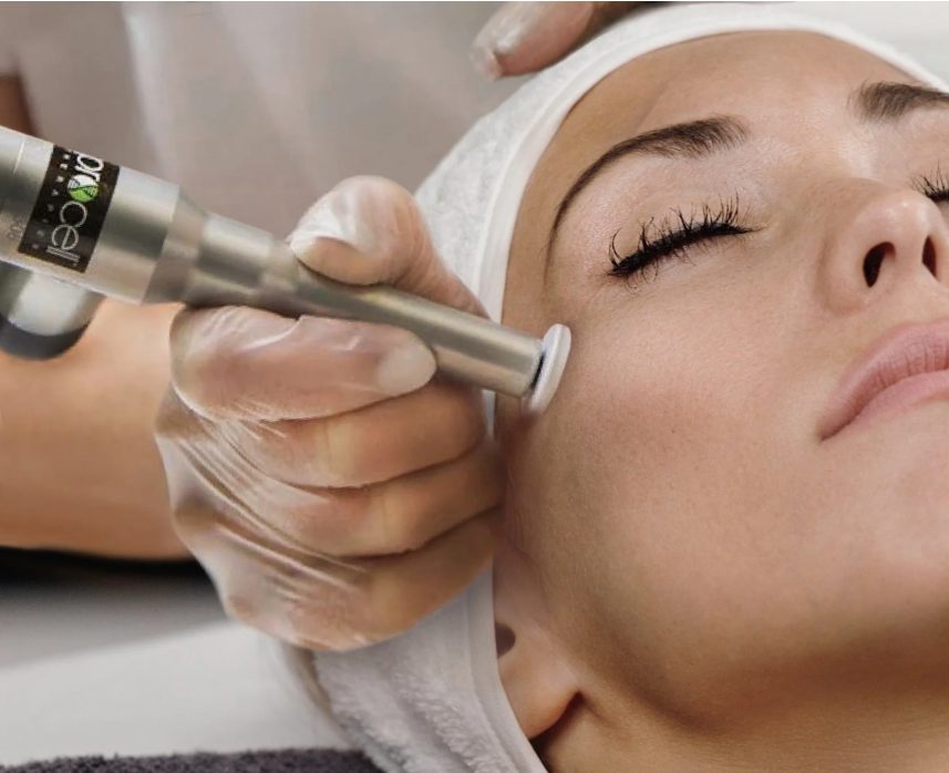 Microchanneling treatment at Le Miracle Skin Clinic, Ottawa